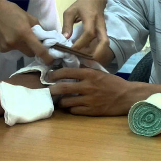 Giáo án Sinh học 8 bài Thực hành Sơ cứu cầm máu