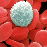 Trắc nghiệm để hiểu về ung thư