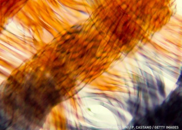 Thử tài suy đoán