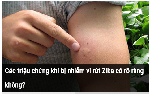 Làm trắc nghiệm để biết bạn có nguy cơ nhiễm vi rút Zika hay không