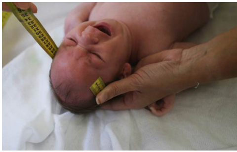 Làm trắc nghiệm để biết bạn có nguy cơ nhiễm vi rút Zika hay không