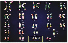 Đề thi học kì 1 môn Sinh học lớp 12 có đáp án