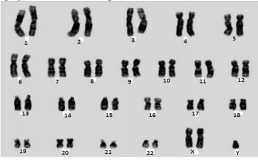Đề thi thử THPT Quốc gia năm 2017 môn Sinh học
