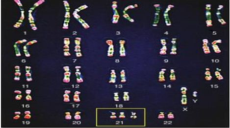 Đề thi học sinh giỏi môn Sinh học lớp 9 tỉnh Hải Dương năm học 2016 - 2017