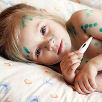 Bài tuyên truyền bệnh thủy đậu