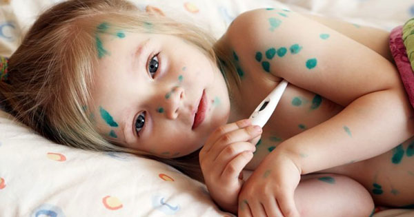 Bài tuyên truyền thủy đậu