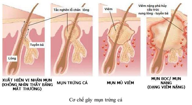 Lý thuyết Sinh học lớp 8 bài 42: Vệ sinh da