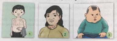 Bạn có biết về các bệnh dinh dưỡng?