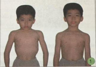 Giải bài 1: Hoạt động thở và cơ quan hô hấp