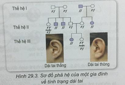 Khoa học tự nhiên 9 Bài 29: Di truyền học người