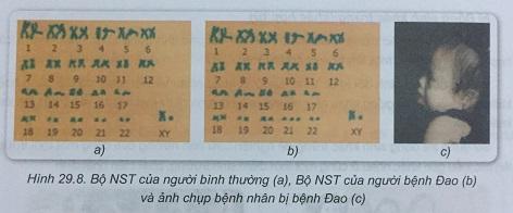 Khoa học tự nhiên 9 Bài 29: Di truyền học người