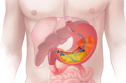 Trắc nghiệm từ vựng Unit 2 lớp 10: Your body and you