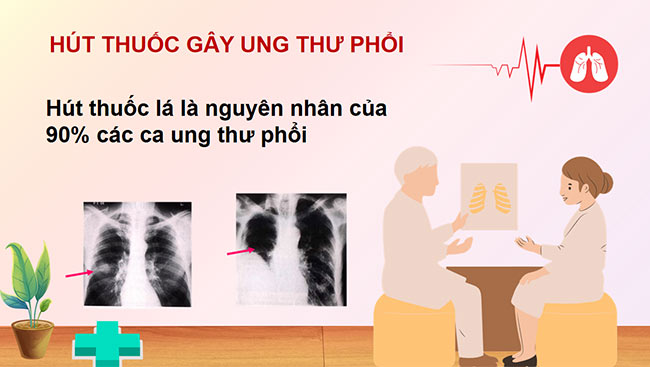 PowerPoint về phòng, chống tác hại của thuốc lá