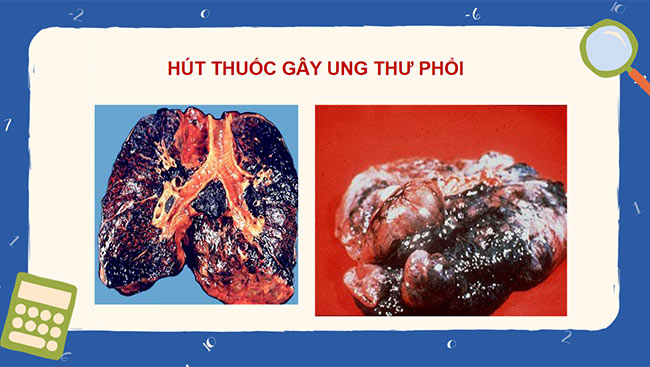 PowerPoint về phòng, chống tác hại của thuốc lá