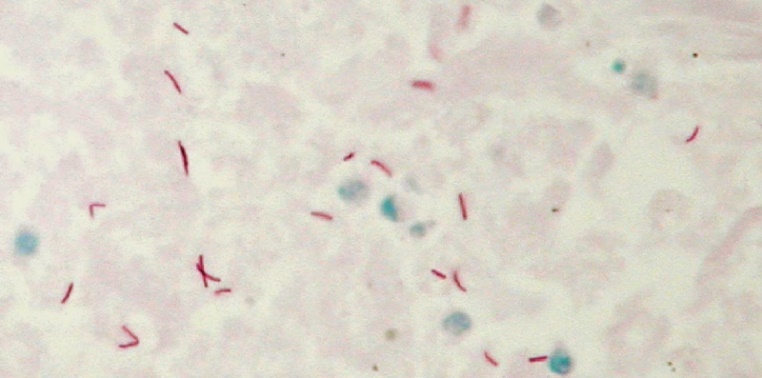 Lý thuyết Sinh 10 Kết nối tri thức Bài 20: Sự đa dạng và phương pháp nghiên cứu vi sinh vật