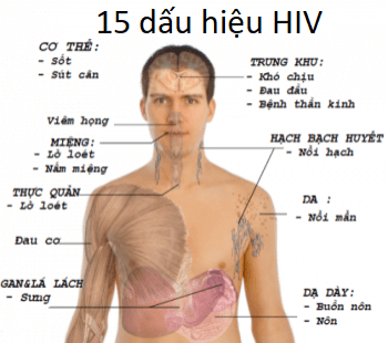 Lý thuyết Sinh 10 Kết nối tri thức Bài 25: Một số bệnh do virus và các thành tựu nghiên cứu ứng dụng virus