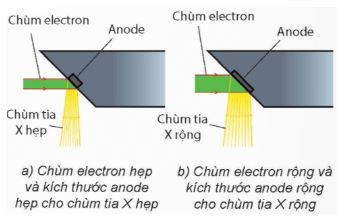 Giải Chuyên đề Vật lí 12 Cánh diều bài 1: Tia X và tạo ảnh bằng tia X