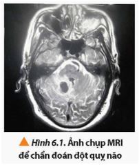 Giải Chuyên đề Vật lí 12 Chân trời sáng tạo bài 6